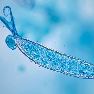 Eliminates parasites and toxins at the source